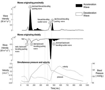 The Use of Maximum Entropy to Enhance Wave Intensity Analysis: An Application to Coronary Arteries in Hypertrophic Obstructive Cardiomyopathy